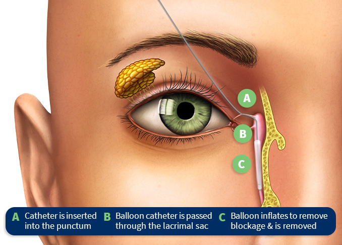 Features and Benefits