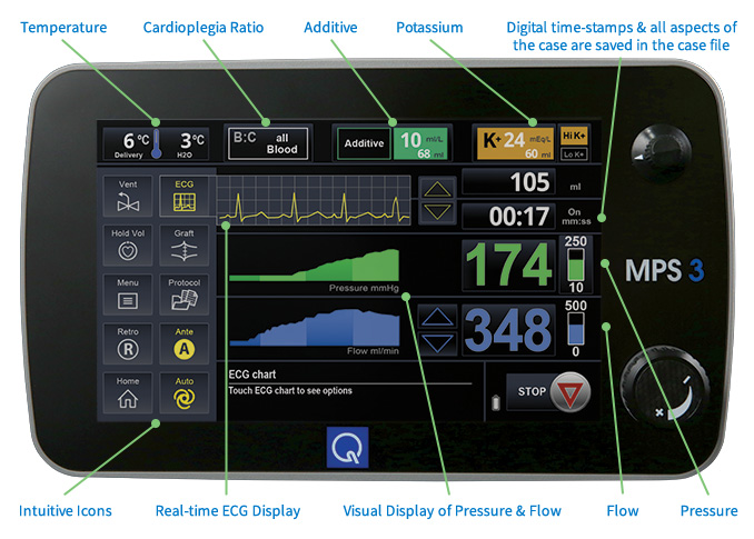 Active Monitoring Controller