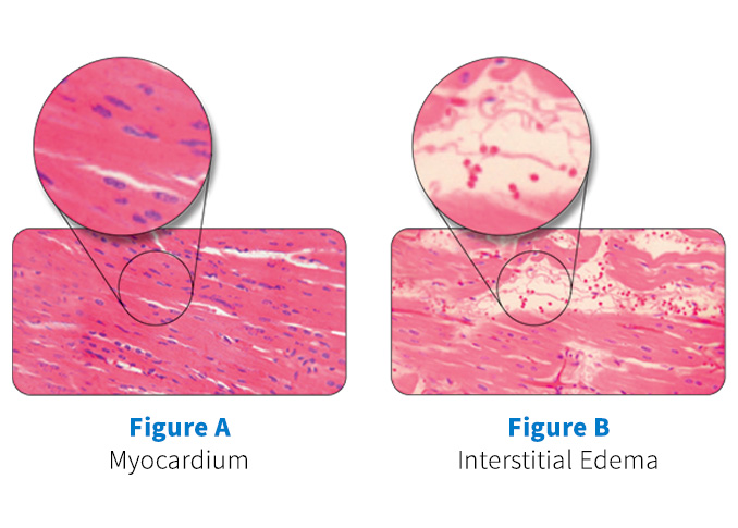 Microplegia Confidence