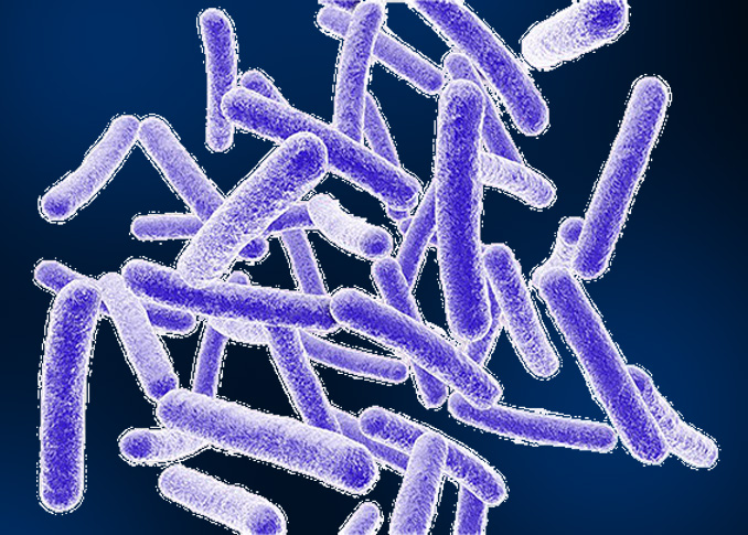 Mitigate Risk of M. Chimaera