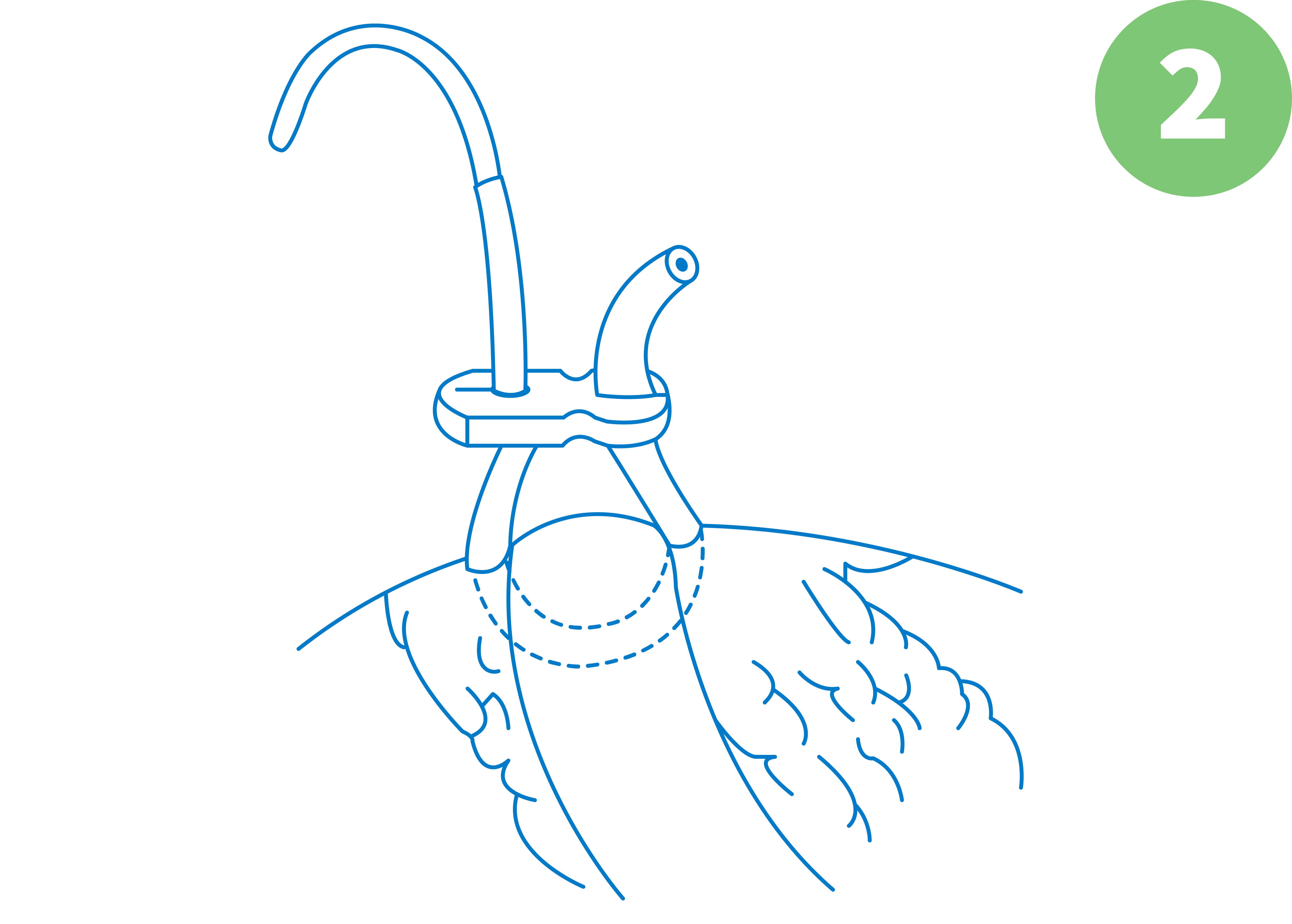 SaddleLoop Technique 2