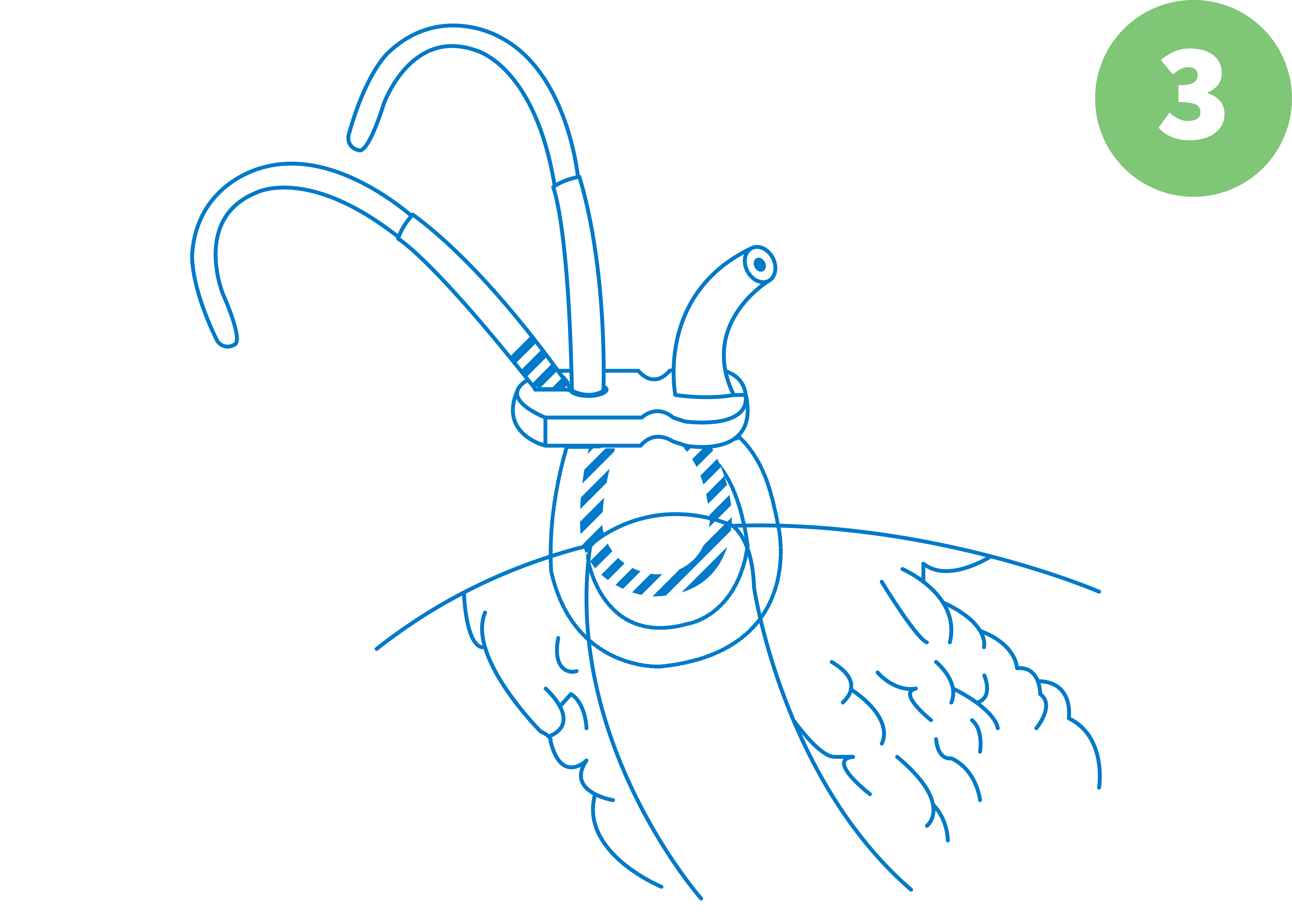 SaddleLoop Technique 3